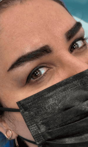کاشت چند زاویه