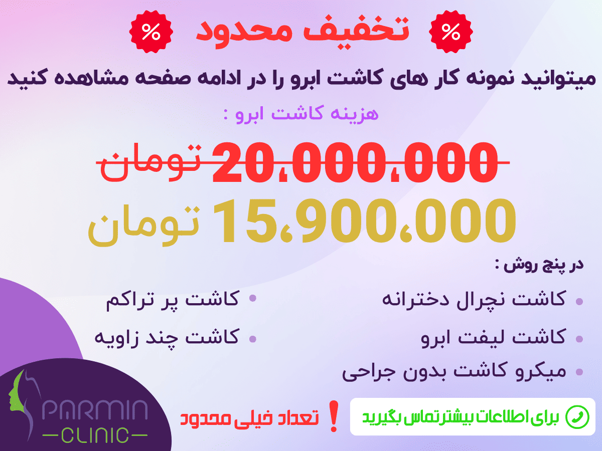 موبایل کاشت ابرو
