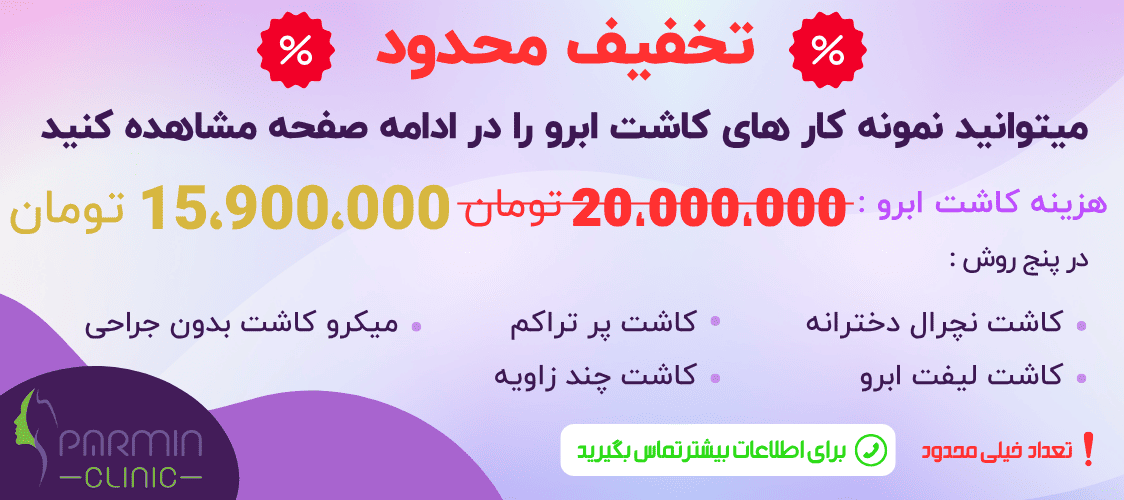 کاشت ابرو